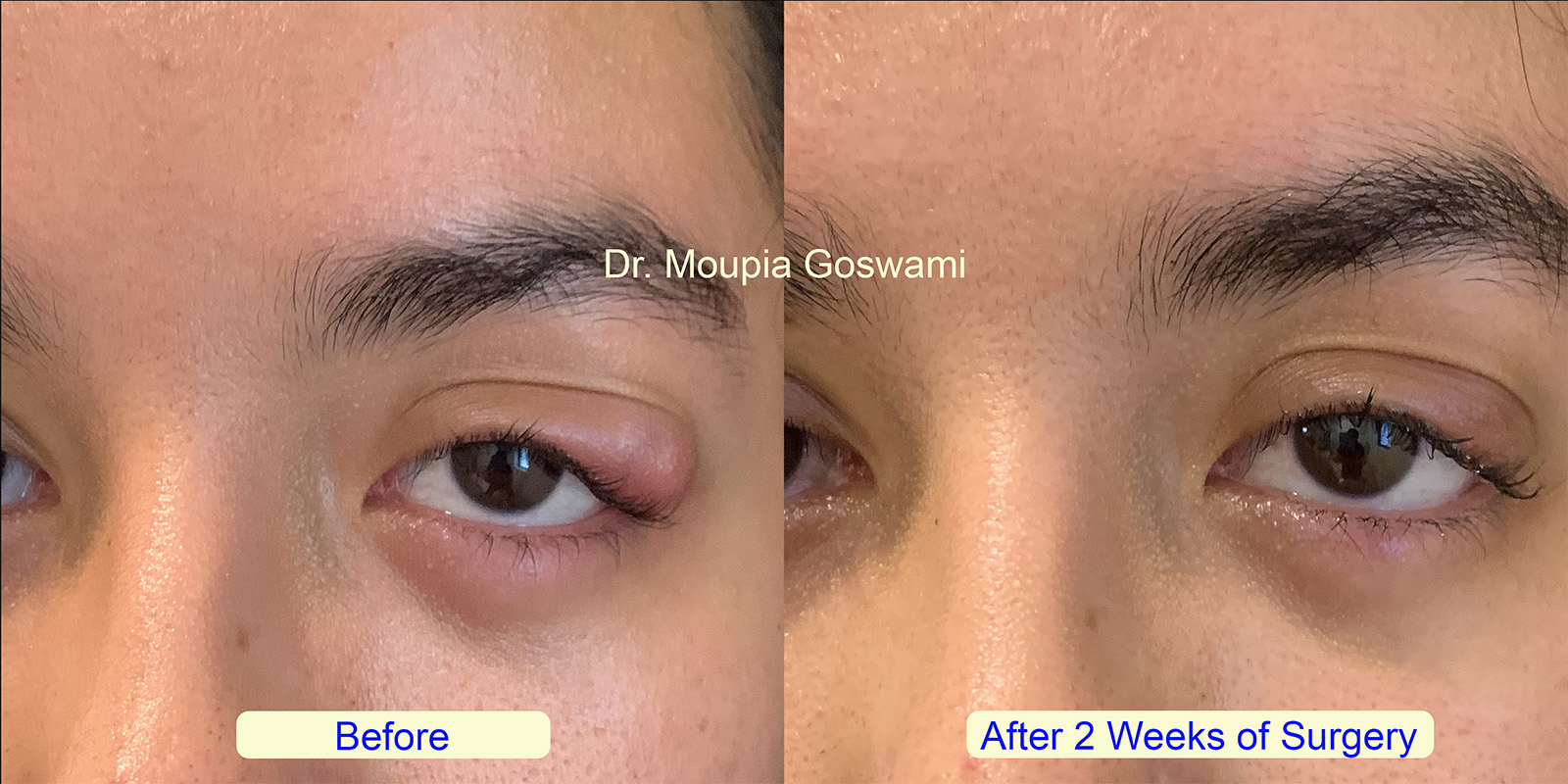 Before and After Comparison