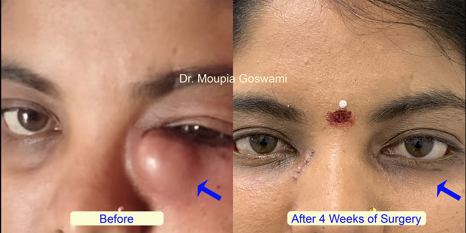 Before and After Comparison