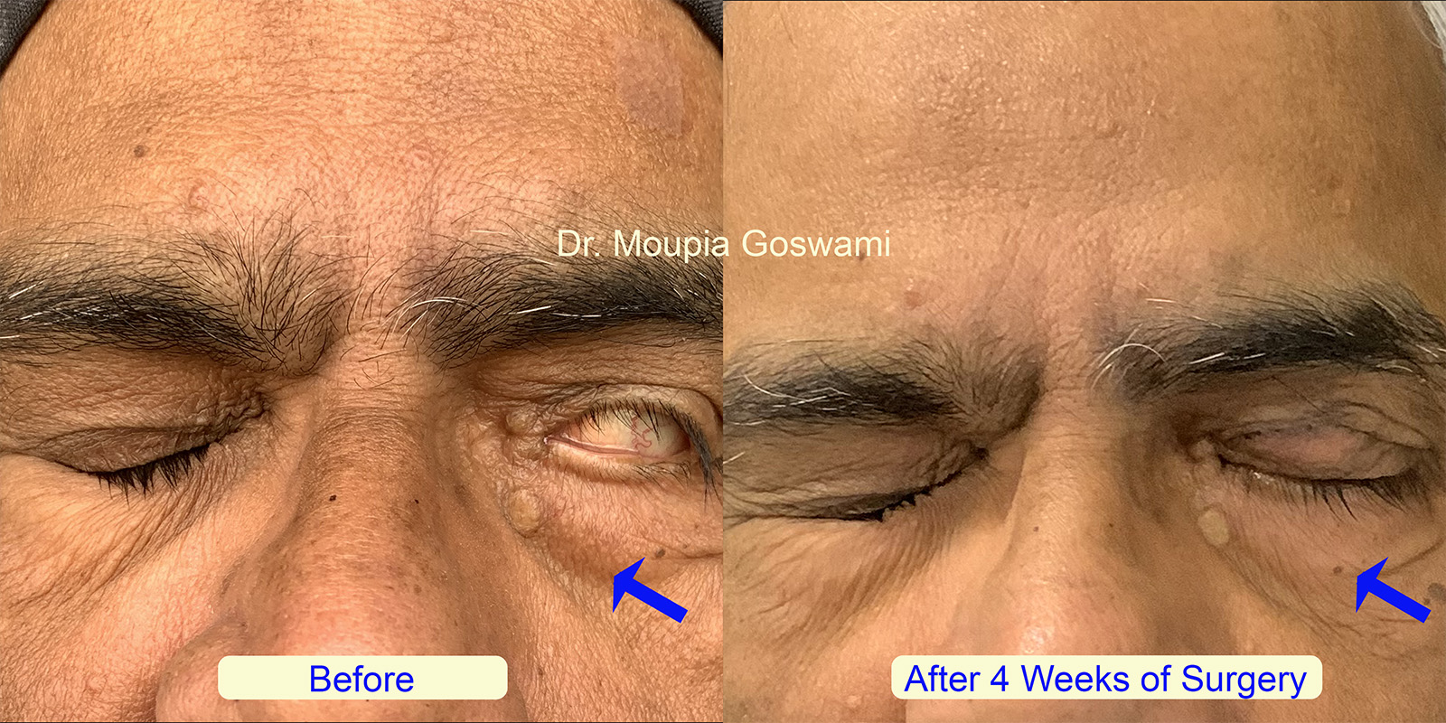 Before and After Comparison