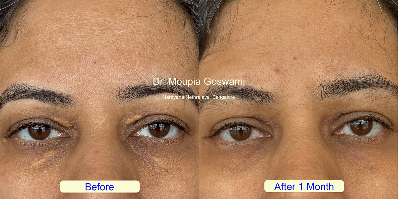 Before and After Comparison