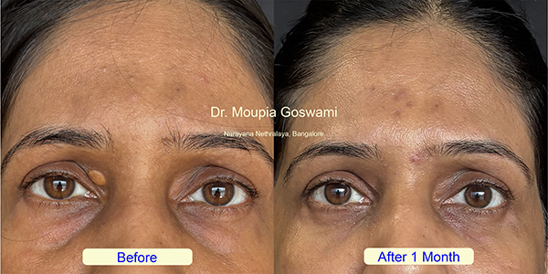 Before and After Image