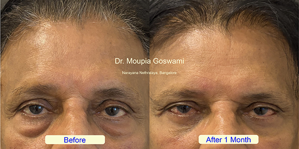 Before and After Image