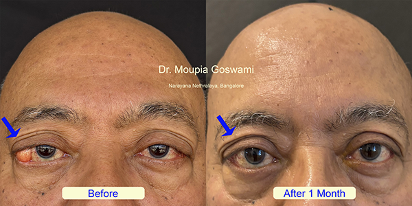 Before and After Image