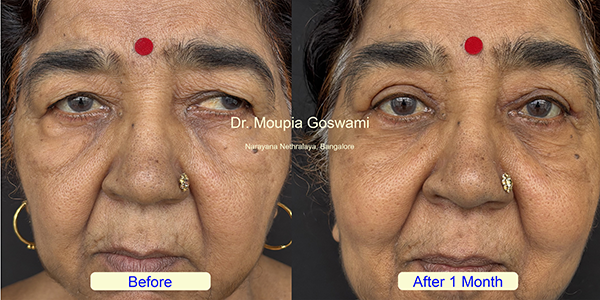 Before and After Image