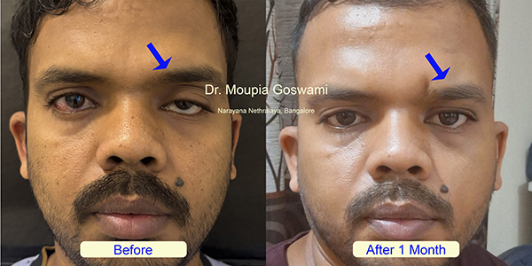 Before and After Image